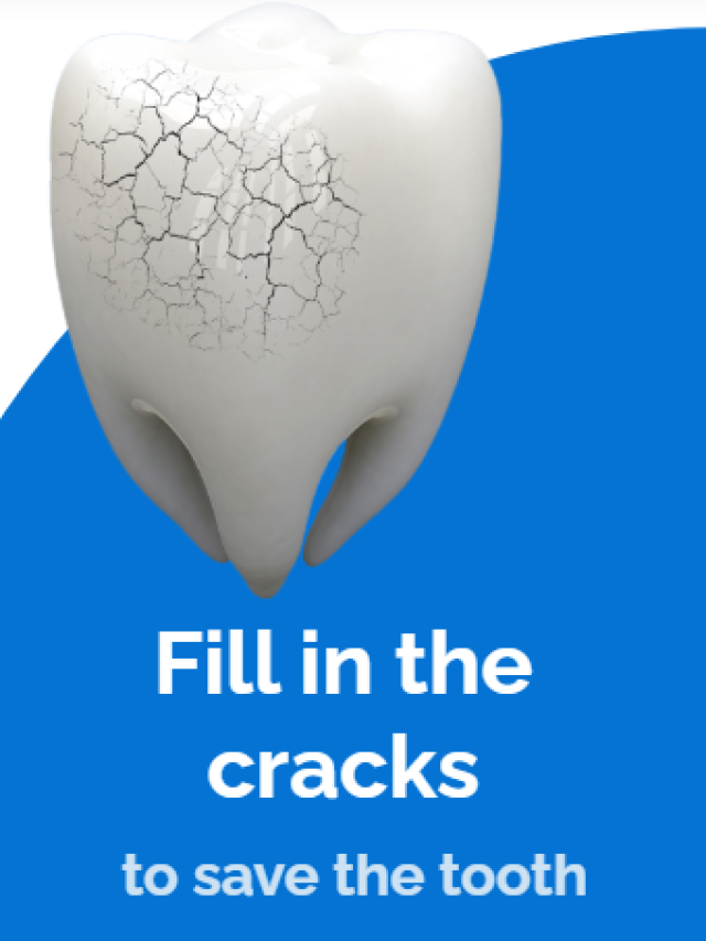 Fill in the cracks to save the tooth